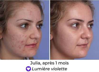 Masque LED Thérapeutique – Soin Visage Éclat et Rajeunissement