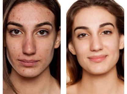 Masque LED Thérapeutique – Soin Visage Éclat et Rajeunissement